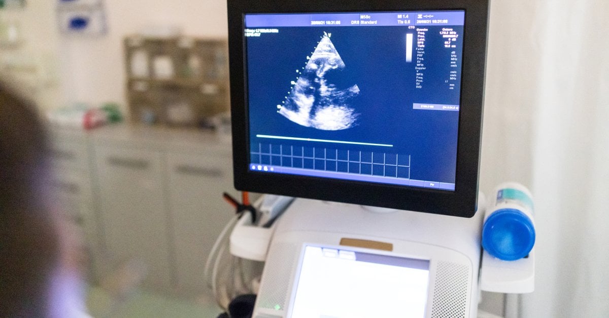 How Hypertrophic Cardiomyopathy Is Diagnosed