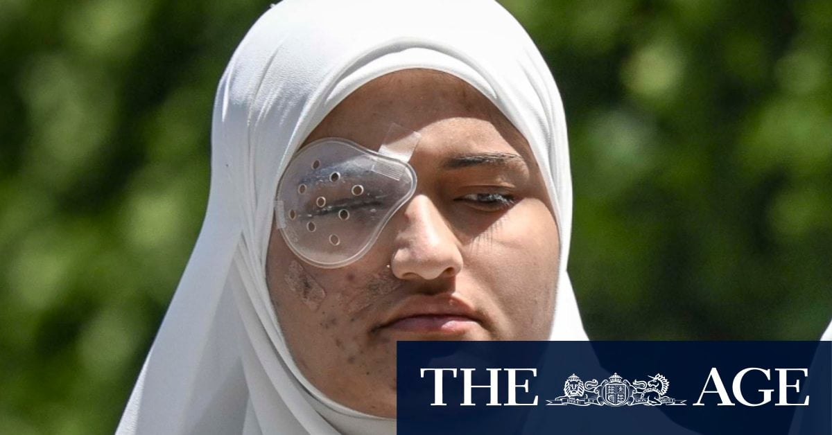 Australian student allegedly shot by Israeli army has eye removed