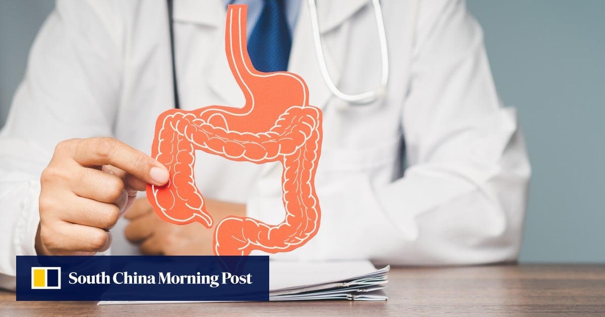 Cheap, non-invasive tool that detects bowel disease coming in 2027: Hong Kong scientists