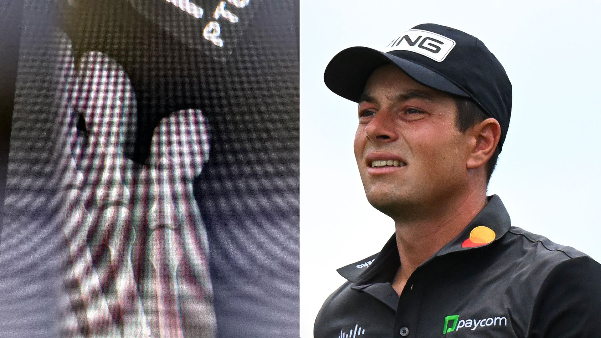 Golf star Viktor Hovland suffers freak bedroom injury as he shares X-ray picture