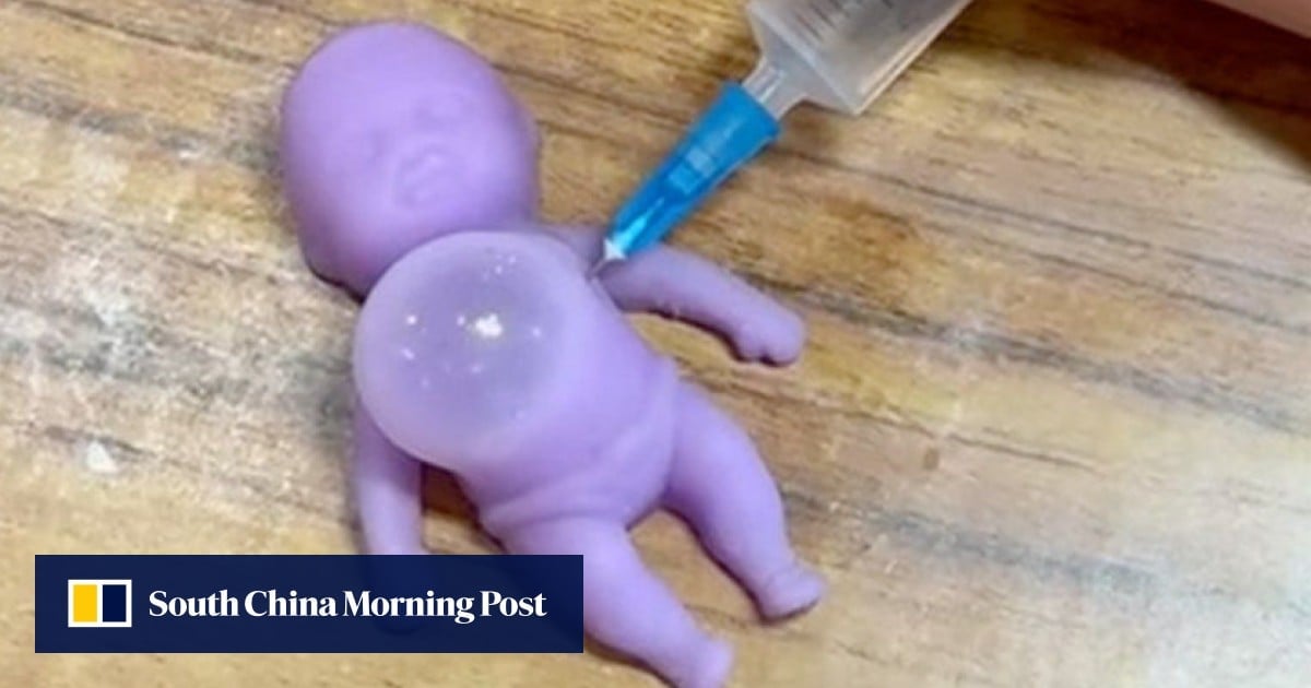 Hong Kong customs warns parents about inflatable toy with syringe