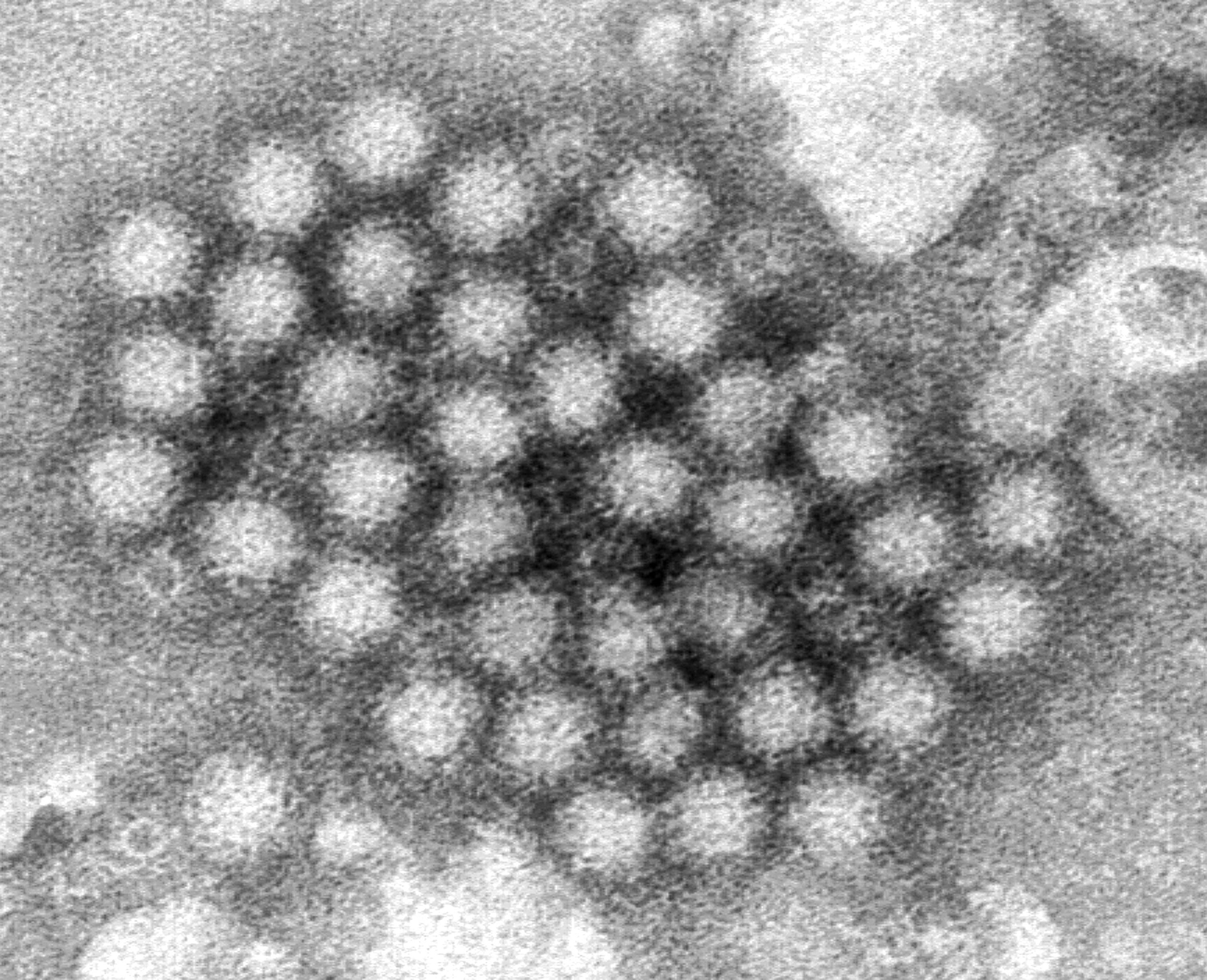 Nasty norovirus is back in full force with US cases of the stomach virus surging