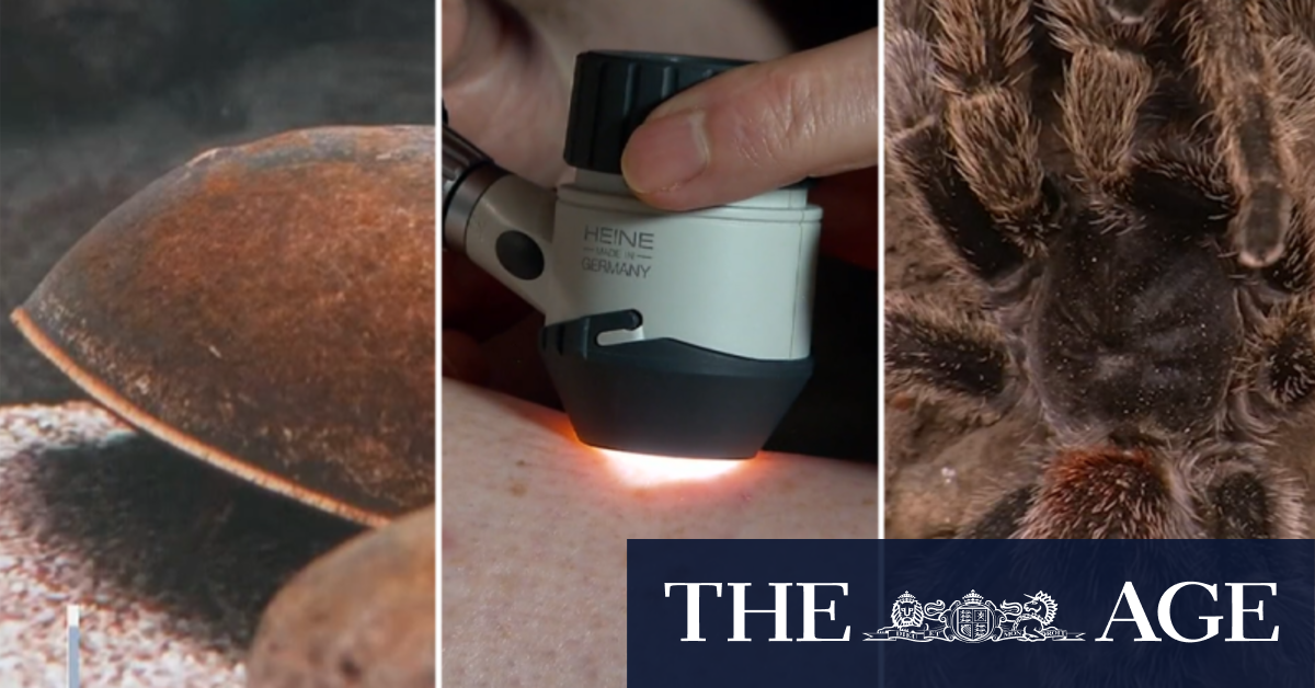 Scientists using spiders and crabs to fight melanoma