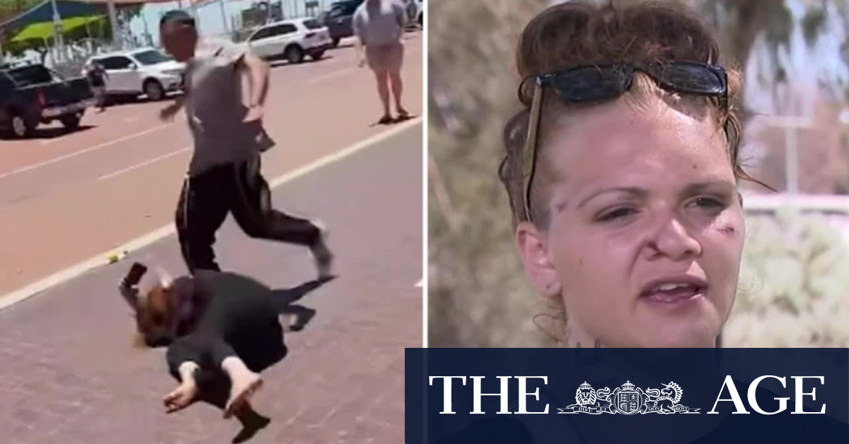 WA woman left bloodied and bruised in shocking attack