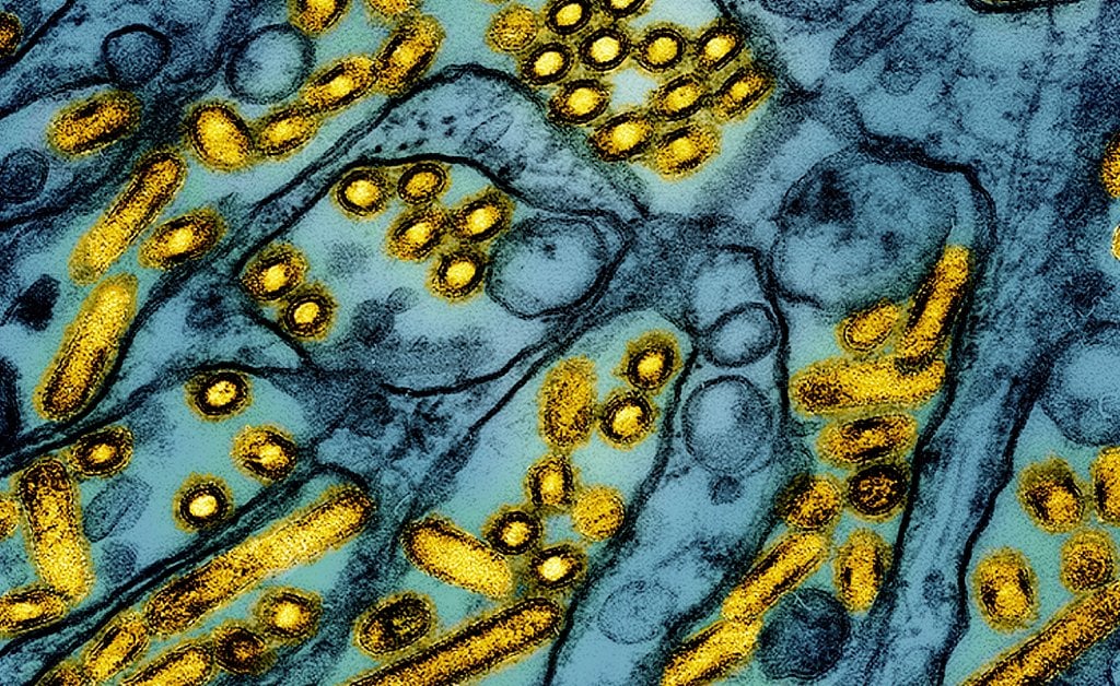 Louisiana Person Is the First U.S. Bird Flu Death, Health Officials Say