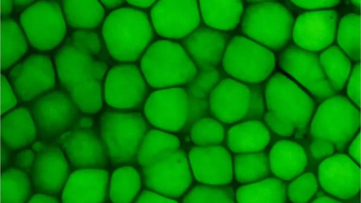 New Cartilage Type Found: Lipocartilage Resembles Fat, Boosts Elasticity